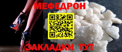 apvp Обнинск